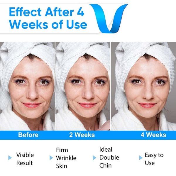 Electric V-Face Shaping Massager – Facial Lifting, Contouring & Double Chin Reduction